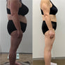 Formnovélle Body Contouring