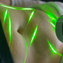 Formnovélle Body Contouring